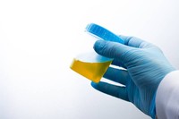 creatinine-urinaire-taux