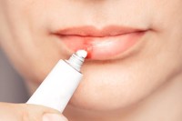 creme-herpes-labial