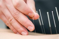 point-acupuncture-pied-pour-maigrir