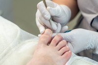 comment-soigner-un-ongle-incarne