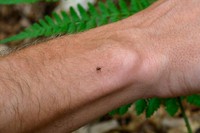 maladie-de-lyme-symptomes
