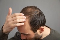greffe-de-cheveux-prix-turquie
