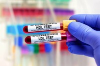 cholesterol-hdl-bon-ou-mauvais