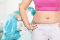 facteurs-qui-influencent-prix-liposuccion-ventre