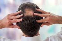 symptomes-alopecie