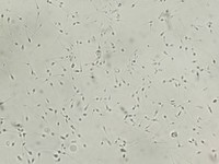solutions-infertilite