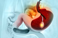 ballon-gastrique-allurion-avis