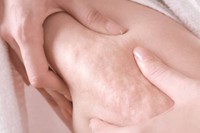 somatoline-cellulite-15-jours
