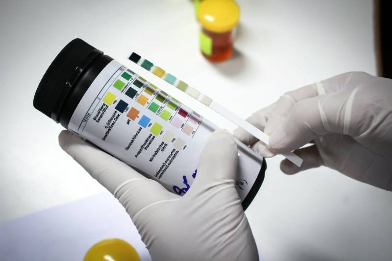 Analyseur D'urine McKesson Consult - 60 Tests/h Avec Bandelettes - Pour Labo Ou Cabinet Médical