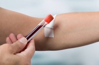 comment-est-calcule-cholesterol-ldl