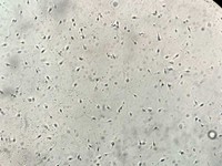 spermatozoides-vrai