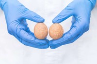 varice-testicule