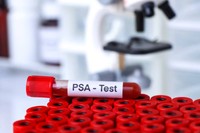 taux-de-psa-normal