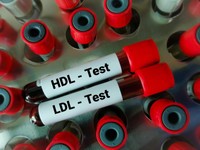 qu-est-ce-que-cholesterol-ldl