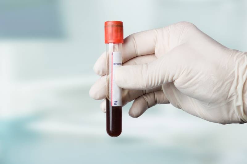 Leucocytes taux élevés, bas et normaux Charles.co