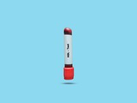 cause-cholesterol-hdl-trop-bas