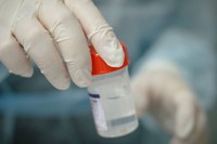biopsie-prostate-effets-secondaires