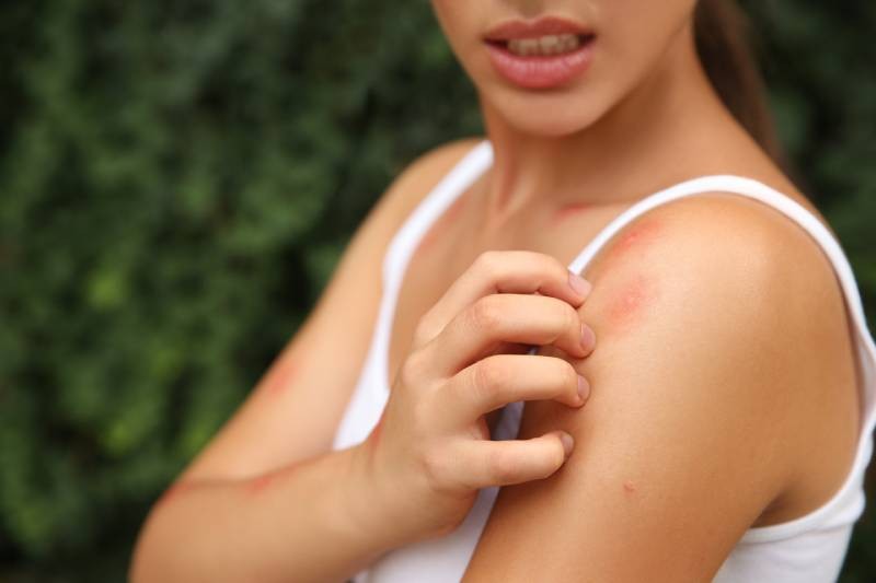 Piqûre moustique allergie, remèdes et solutions pour se soulager — free download
