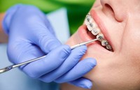 orthodontie-remboursement