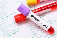 calcul-rapport-cholesterol-total-hdl