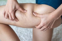 somatoline-cellulite-avis