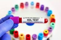 Cholestérol HDL bas : symptômes, causes, taux et que faire ...