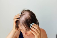 causes-alopecie