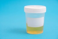 urine-foncee-et-mal-de-dos