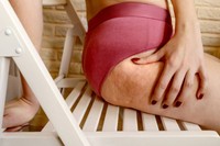 somatoline-cellulite-incrustee