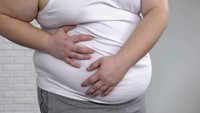 obesite-definition