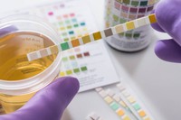 realiser-des-analyses-pour-soigner-infection-urinaire