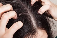 shampoing-pellicule