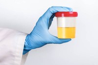 creatinine-urinaire-norme