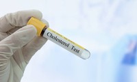 qu-est-ce-que-le-cholesterol-hdl