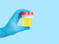 test-infection-urinaire
