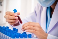 uree-creatinine