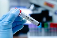 cholesterol-hdl-bon-mauvais