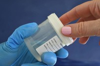 creatinine-urinaire-enceinte