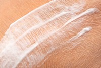 creme-eczema-sans-ordonnance