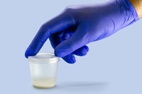 aspect-sperme-sterile