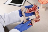 qu-est-ce-qui-cause-le-cancer-du-colon
