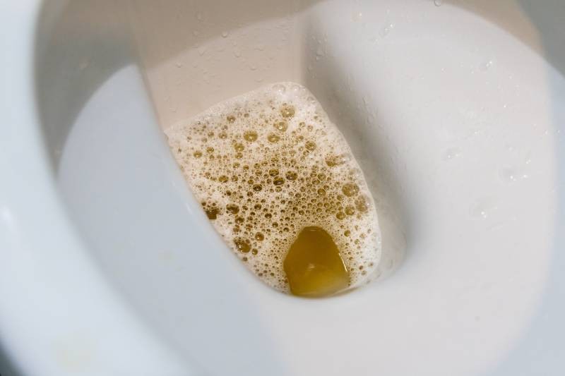 Urine foncée fautil s’inquiéter ? Quelles en sont les causes