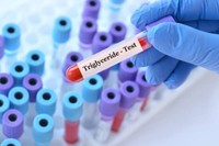 triglycerides-taux-normal