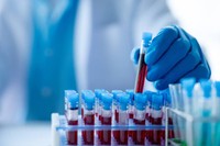 creatinine-elevee-traitement