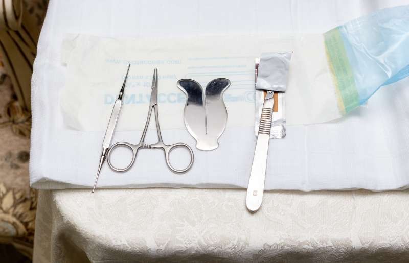 Circoncision déroulement de l’opération et cicatrisation Charles.co
