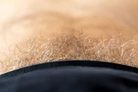 epilation-pubis