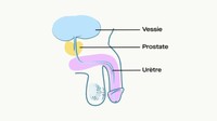 qu-est-ce-qu-une-prostatite