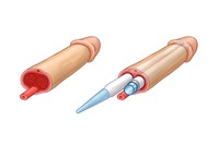 faire poser un implant pénien