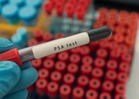 psa-prise-de-sang