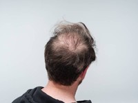 luxeol-pousse-cheveux-3-mois